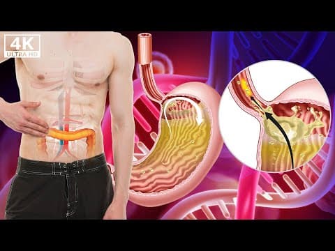 Eliminate Digestive Diseases - No More Gastric Reflux - Immediately Restore Internal Organs #1