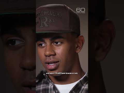 Lamine Yamal’s signature look: braces #shorts