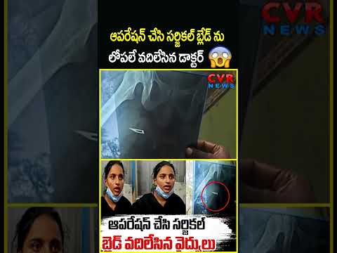 ఆపరేషన్ చేసి సర్జికల్ బ్లేడ్ ను లోపలే వదిలేసిన డాక్టర్ | Doctor Viral Video | CVR NEWS